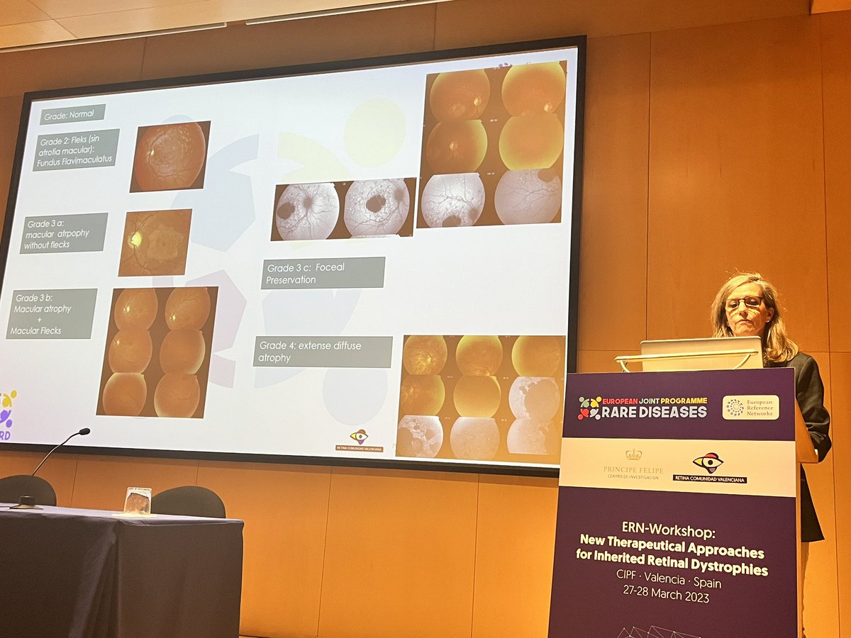 AnaPilarGomez's tweet photo. Talk 8 #ERNworkshop #retinaldystrophies
Dr. Blanca García from @Hospital_FJD @CIBERER shows us clinical trials using Emixustat drug to treat DMAE and stargardt disease by inhibiting RPE65 to reduce vitamin A pathway synthesis
@CIPFciencia @ReginaRodrigo_ https://t.co/yiJGlNP5hC