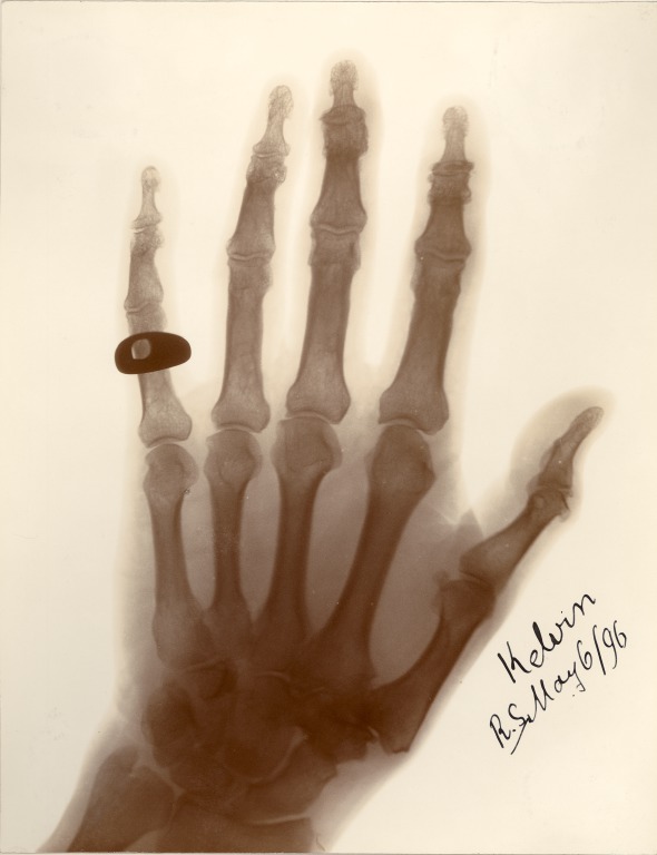 royalsociety's tweet photo. Born #OnThisDay in 1845 was Wilhelm Röntgen, the German physicist who first identified X-rays, for which he won the first Nobel Prize in Physics in1 901. The X-ray below shows the hand of Lord Kelvin, complete with signet ring, and was taken at the Royal Society in 1896. #Physics https://t.co/AW1mG5NAoC