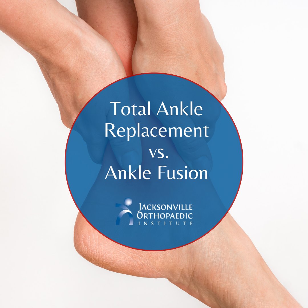 JaxOrthopaedic's tweet image. When you choose to have a total ankle replacement instead of an ankle fusion, you are choosing to have a healthy new ankle instead of a fused ankle. You are reducing your recovery time and decreasing your chances of re-operation. #totalanklereplacement #surgreycenter
