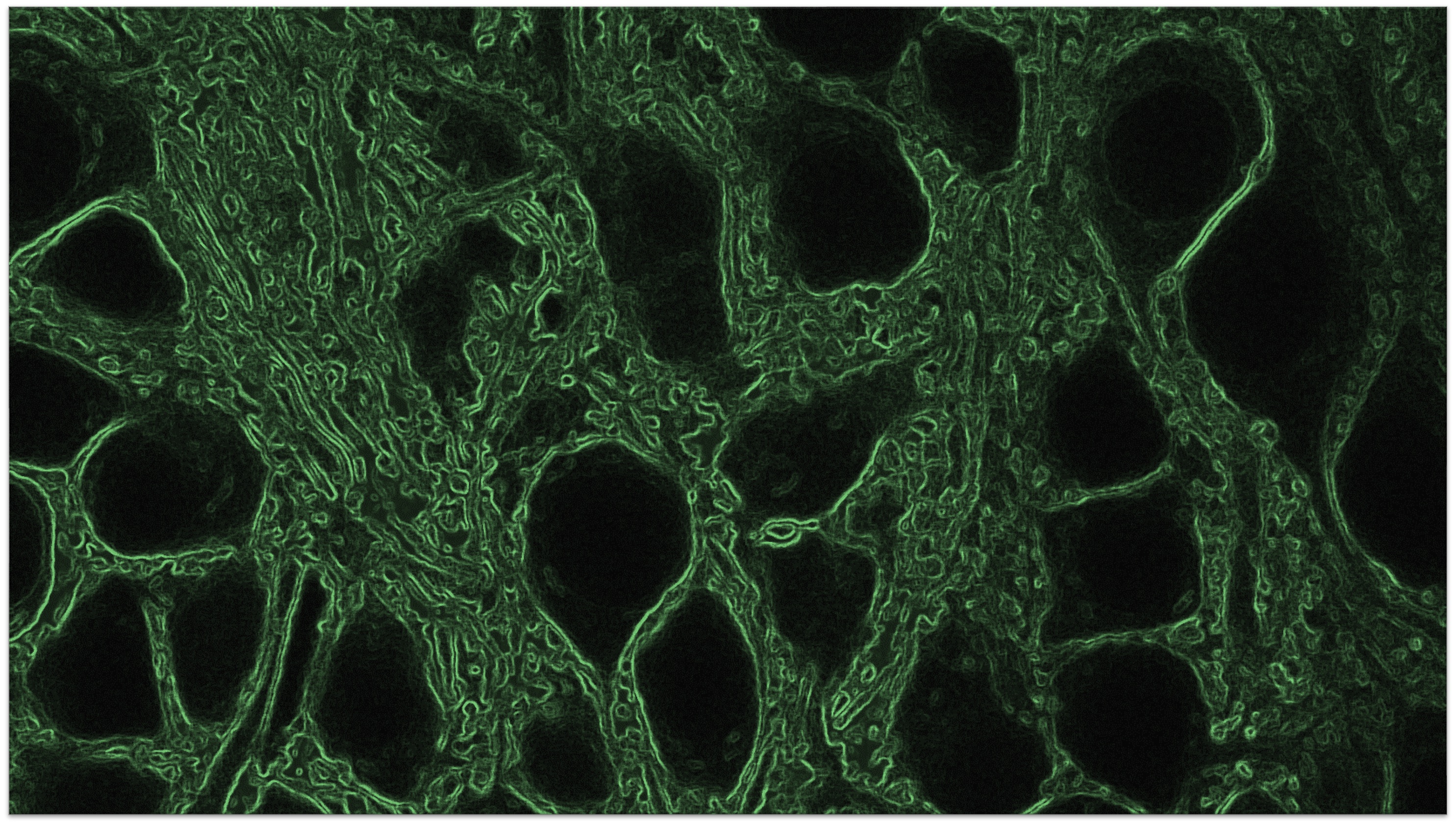 Shadow imaging for panoptical visualization of brain tissue in