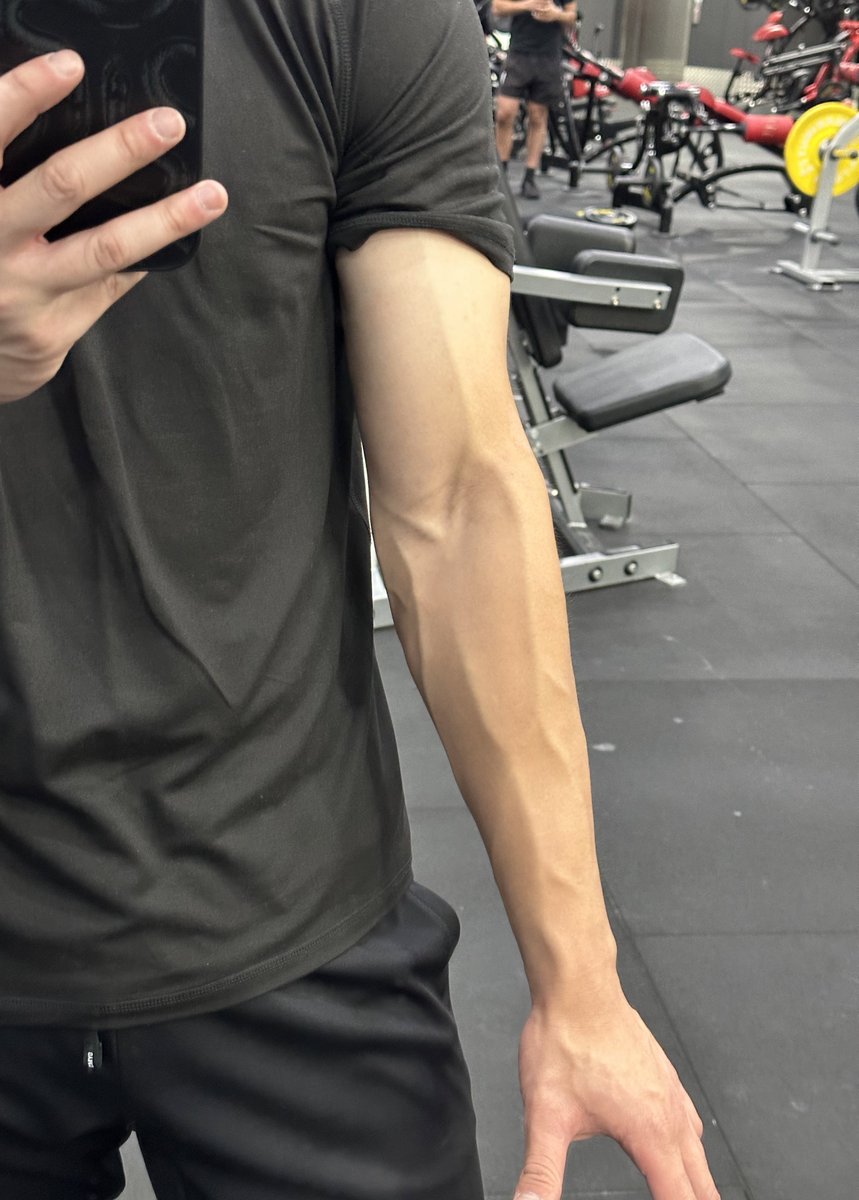 petermkle's tweet photo. Veins https://t.co/FpRnLBbMmK