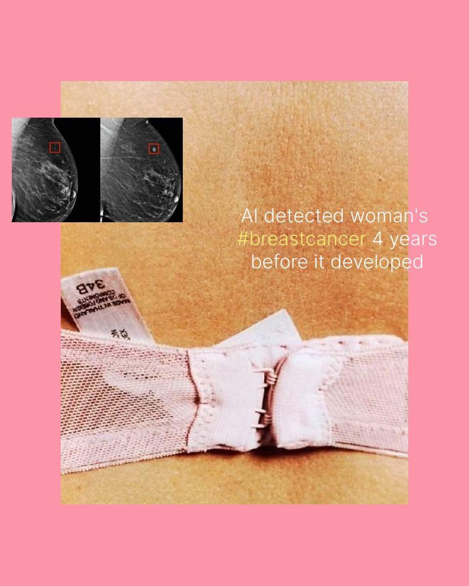 pinkoctobermeta's tweet photo. 🚨Exciting news!🚨 #AI detects #breastcancer 4 years before it develops. This technology is being tested in multiple countries &amp; could be a game-changer for cancer detection rates. 

Let's discuss - what do you think of AI in healthcare? #healthtech  #cancerdetection https://t.co/L1Lg8W0J1I