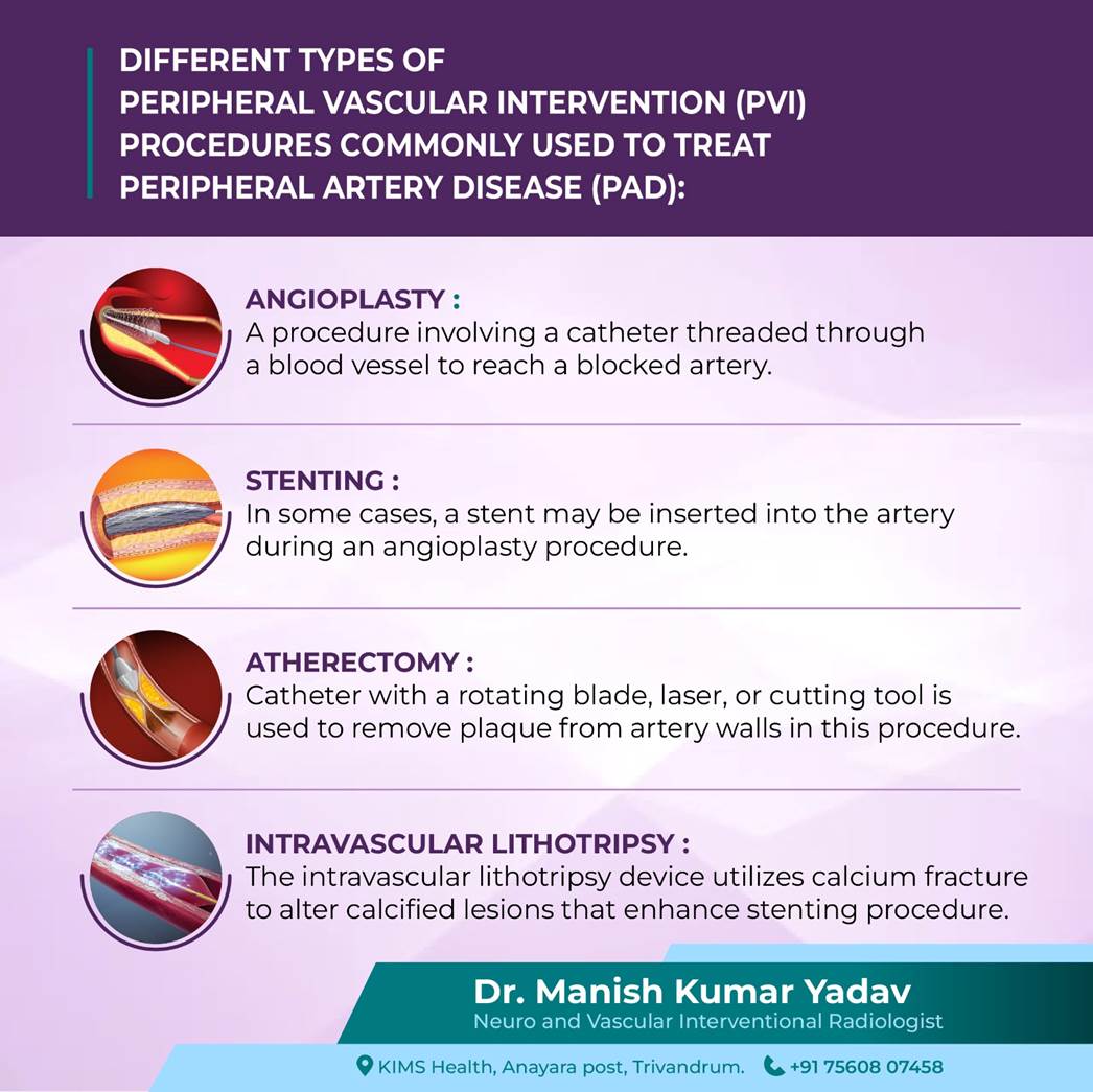 In most cases, patients are able to resume their normal activities within a few days to a week after PVI procedure. Call  +91 75608 07458
#PeripheralVascularIntervention #PVI
#PeripheralArteryDisease #PAD
#InterventionalRadiology
#MinimallyInvasive 
#DrManishKumarYadav