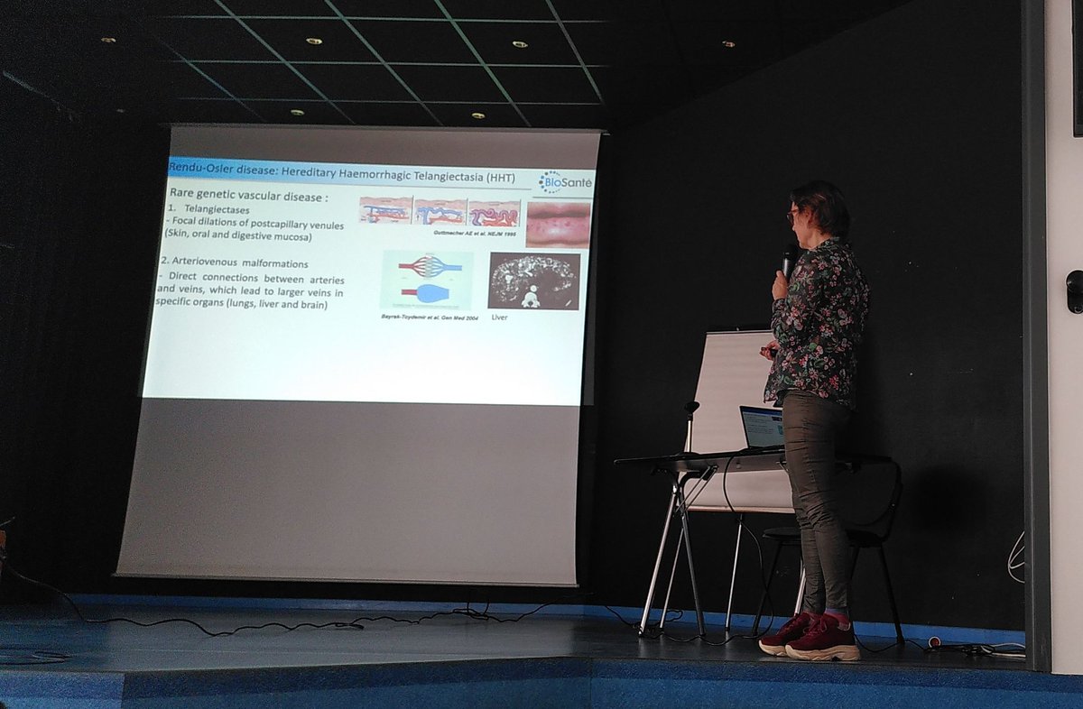 LabexGRAL's tweet photo. Sabine Bailly from @BaillyLab explains the molecular mechanisms of the Rendu-Osler syndrome

@VACure1 #48hofGRAL https://t.co/yj1D7yhrxv