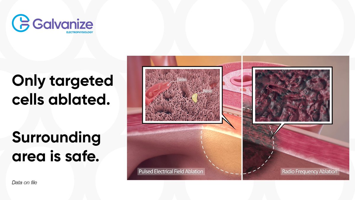 Galvanize Electrophysiology tweet media