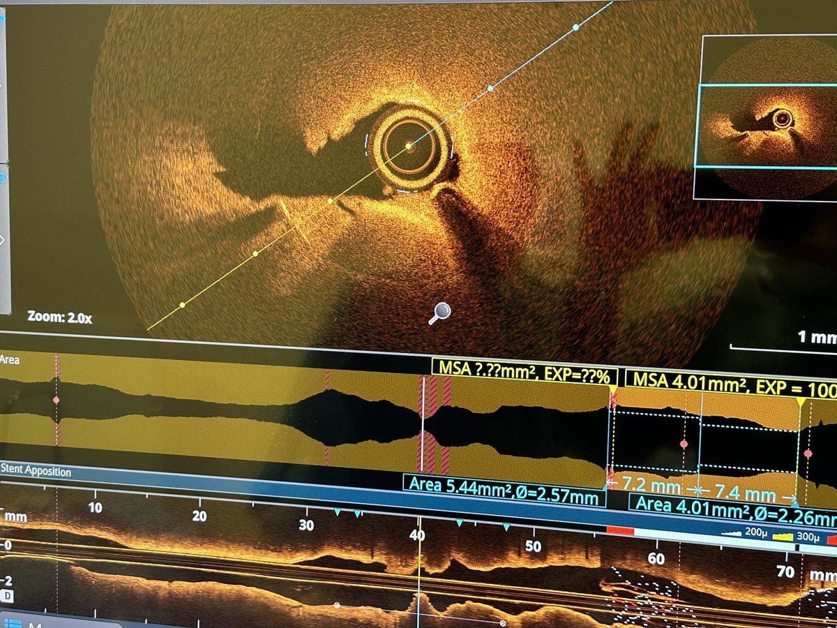 Mamas A. Mamas tweet media