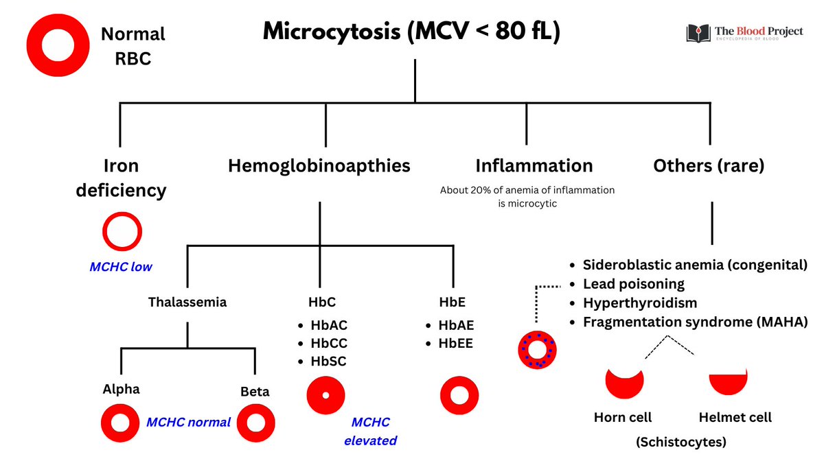 WilliamAird4's tweet image. APPROACH TO MICROCYTOSIS

For more information, see infographic:

thebloodproject.com/microcytosis-i…