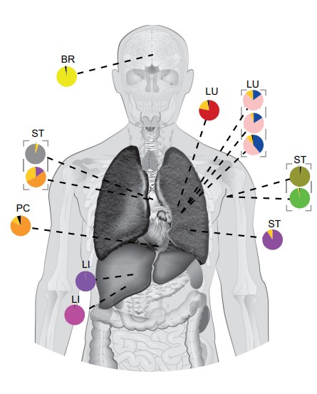 ElizSMcKenna's tweet photo. Now in @CD_AACR: Late-stage Metastatic #Melanoma Emerges through a Diversity of Evolutionary Pathways - by @SpainLavinia @coulton_alex @IreneLobon Andrew Rowan, Desiree Schnidrig @kevlitchfield @CharlesSwanton @MariamJHanjani @TurajlicLab et al. @TheCrick https://t.co/Sml0fyuHAu https://t.co/BOGZ7J7EpP