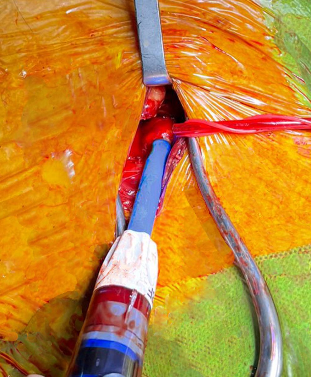 Germán Chaud tweet media