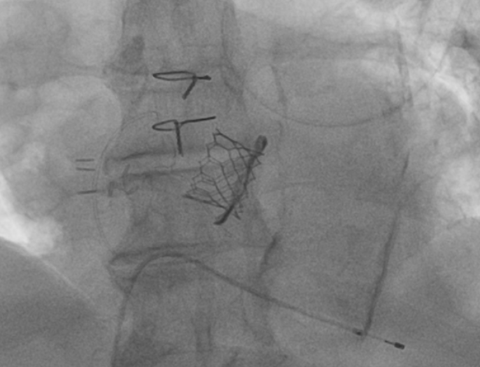 Germán Chaud tweet media