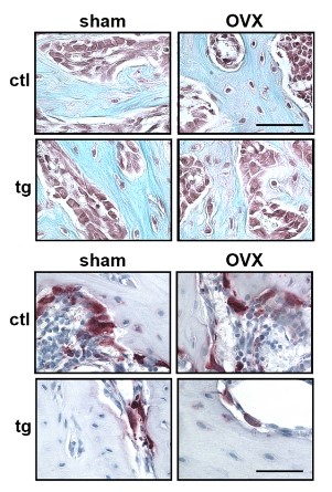 The Journal of Bone and Mineral Research tweet media