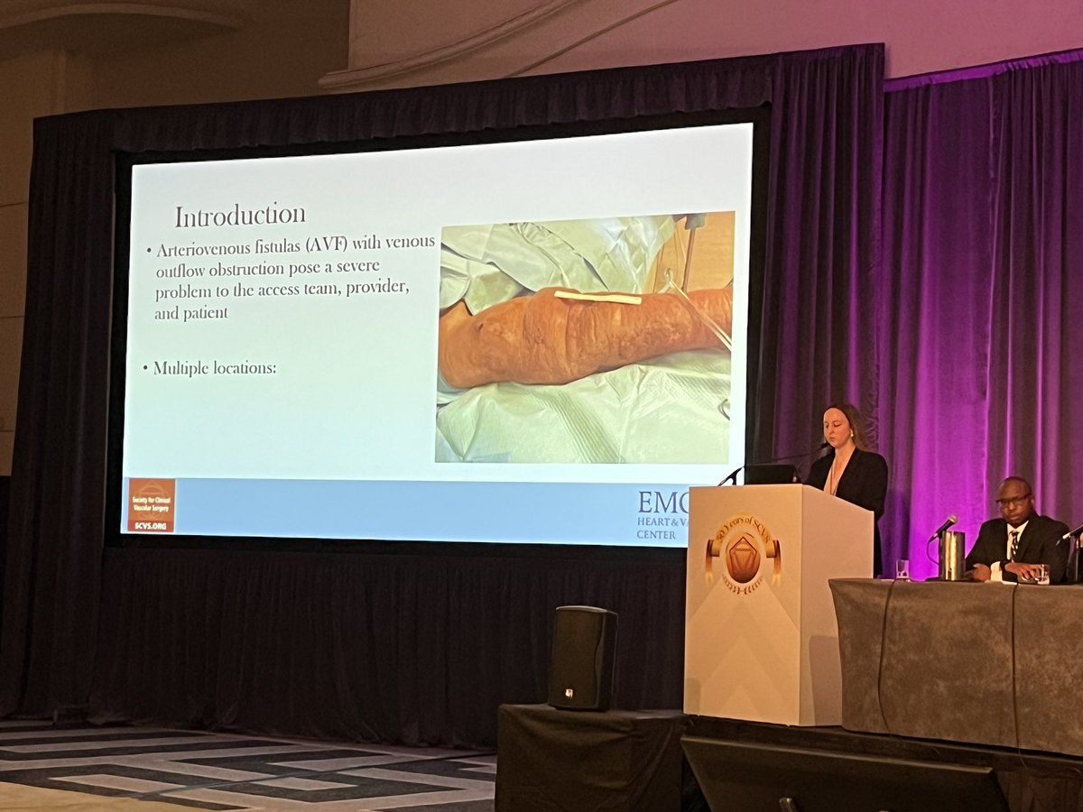Guillermo Escobar🩸 (@gaescobarmd) on Twitter photo <a href="/EmoryVascSurg/">Emory Division of Vascular Surgery</a> ‘s <a href="/BrandiMizeMD/">Brandi Mize</a> did a SUPERB job presenting our data <a href="/scvs/">simone cristina</a> on our results with translocation of a patent, mature AVF to the contralateral extremity when there is central outflow occlusion…instead of ligating and starting over with ? maturity.
♻️That vein!! <a href="/EmoryVascSurg/">Emory Division of Vascular Surgery</a> ‘s <a href="/BrandiMizeMD/">Brandi Mize</a> did a SUPERB job presenting our data <a href="/scvs/">simone cristina</a> on our results with translocation of a patent, mature AVF to the contralateral extremity when there is central outflow occlusion…instead of ligating and starting over with ? maturity.
♻️That vein!!