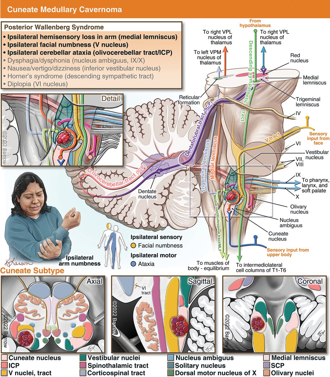 Medical illustration by Kristen Larson Keil