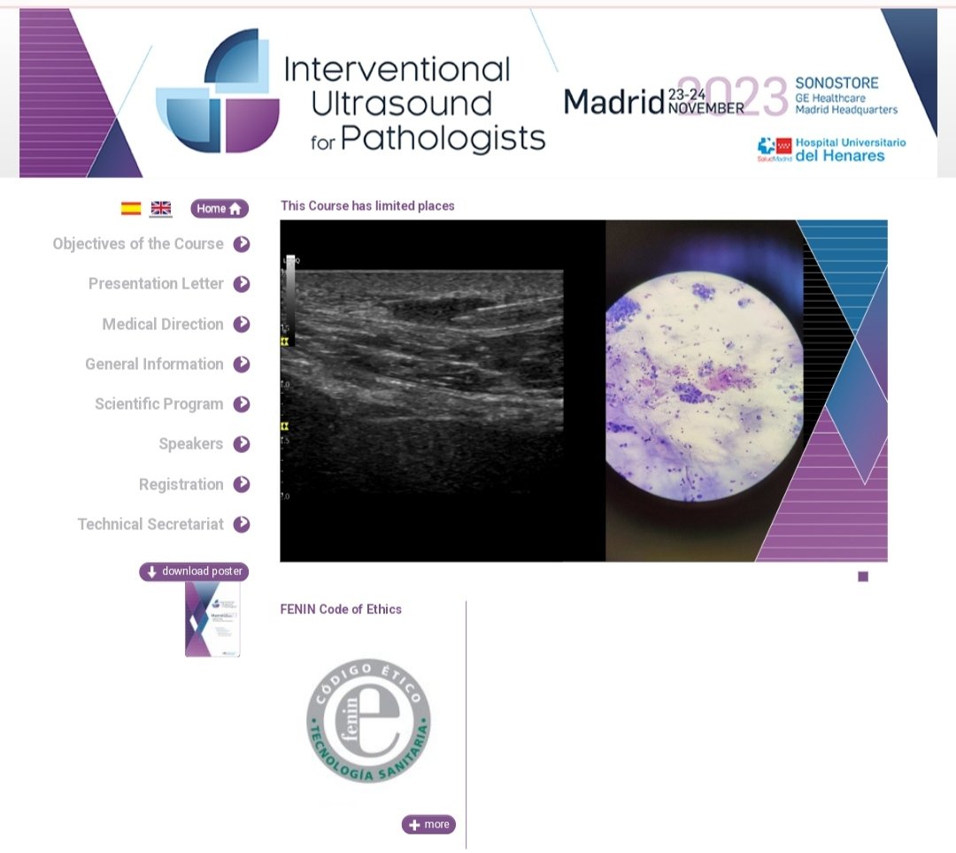 USFNA_SPAIN's tweet image. REGISTRATIONS OPEN.!! eventos.aymon.es/en/interventio…

We'll have an intense couple of days with Ultrasound, FNA and biopsy with hands-on training in small groups.

Oficial language of the course: ENGLISH.

#interventionalpathology #pocus #healthcare #PathTwitter #biopsy #geultrasound