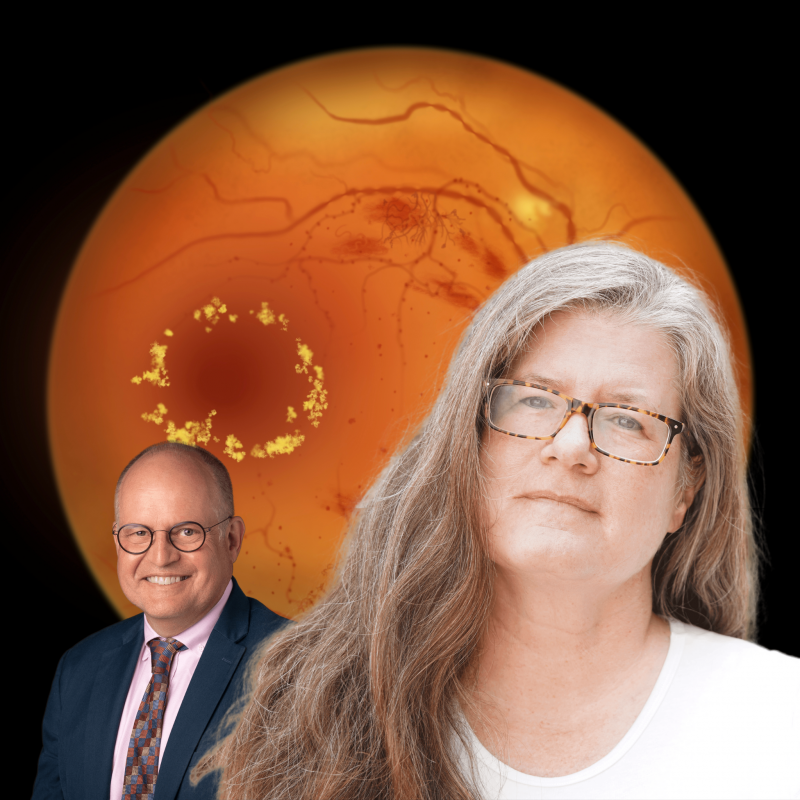 OrgSims's tweet image. New patient to treat with Professor Marc de Smet. Alice is a 57-year-old woman who was referred to the retina service for evaluation of worsening vision associated with diabetic retinopathy (DR) and center-involving diabetic macular edema. Treat Alice at howitreat.md/clinic/diabeti…