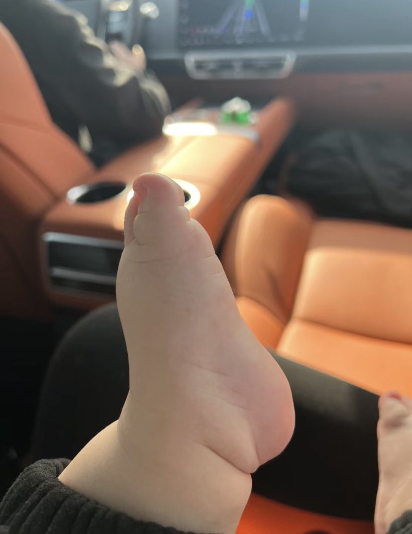 BMWSXJJ's tweet photo. 这小胖脚丫🦶 https://t.co/2JHd16MJV6