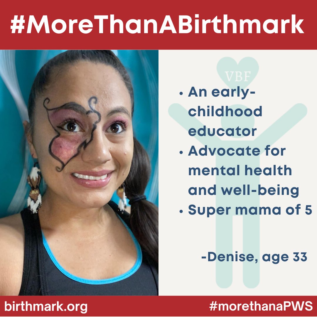 VBirthmarks's tweet photo. YOU are MORE than your Birthmark...I am MORE than MY Birthmark...

#VBF launched the “More Than” Project so that we can learn about you. Learn more: https://t.co/zXuvJ79XvE

#MoreThanABirthmark #VascularBirthmarksFoundation #vascularbirthmarks #MTAB https://t.co/z19cO7r9k9
