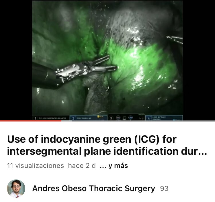 Andres Obeso tweet media