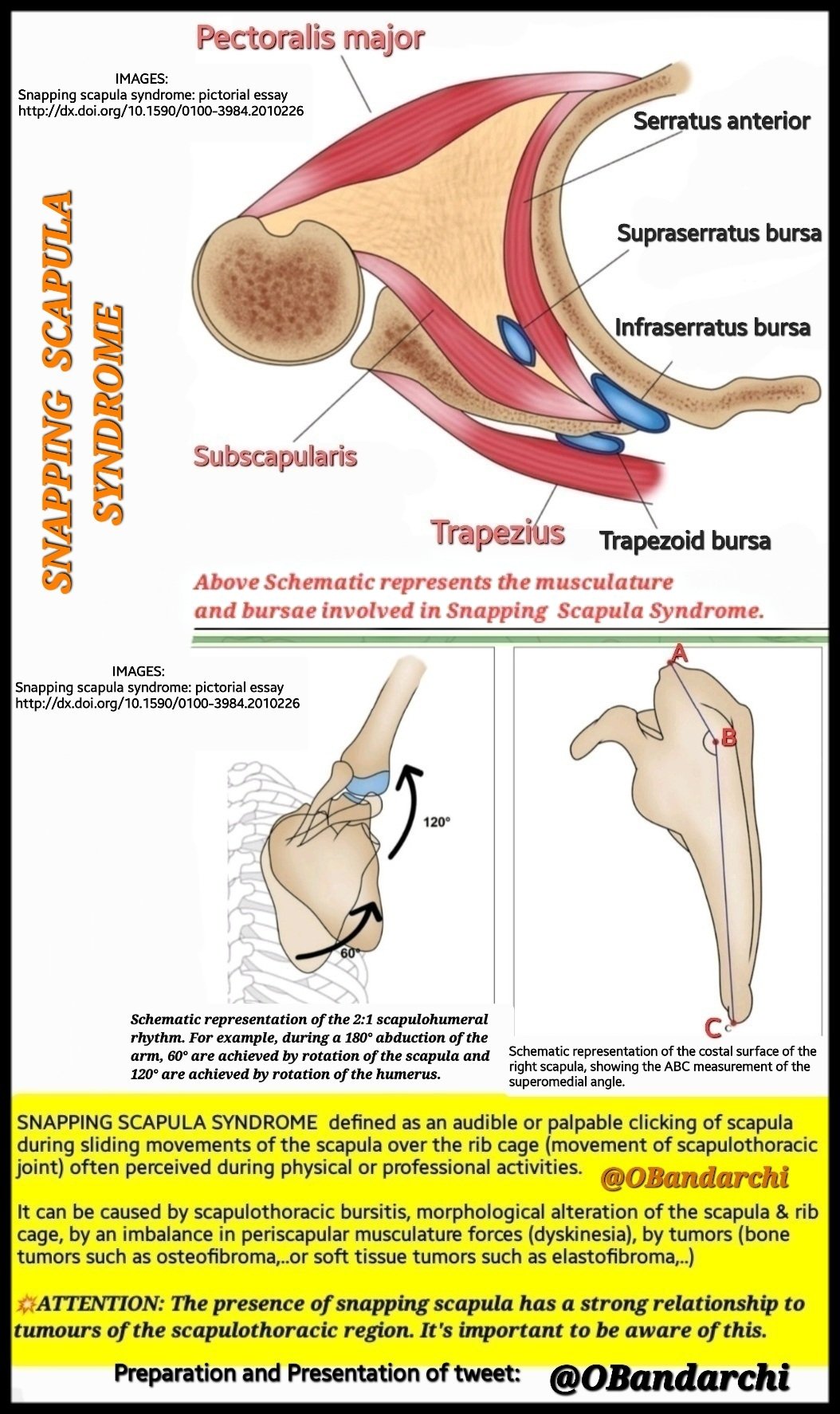 Scapulothoracic Bursitis