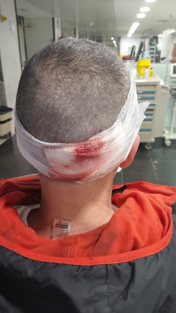 acortesborra's tweet photo. Twitter haz tu magia!
Atropellado por un patinete eléctrico que se ha dado a la fuga a las 15 h a la altura del núm 90 de la calle Hospital de BCN. Buscamos testigos para identificar al indeseable que ha atropellado a nuestro familiar @GUBBarcelona @bcn_ajuntament @mossos https://t.co/CTAXPzU49x