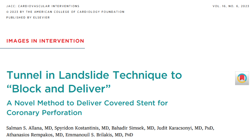 Salman Allana, MD FACC FSCAI (@allanasalman) on Twitter photo Now online <a href="/JACCJournals/">JACC Journals</a>
"TILT to block and deliver" a novel technique to deliver covered stent for coronary perforation.
<a href="/esbrilakis/">Emmanouil Brilakis</a> <a href="/JuditKaracsonyi/">Judit Karacsonyi</a> <a href="/S_Kostantinis/">Spyros Kostantinis</a> <a href="/BahadirSimsekMD/">Baha Simsek</a> <a href="/RempakosT/">Thanasis Rempakos</a> <a href="/LAzzaliniMD/">Lorenzo Azzalini</a> <a href="/MHIF_Heart/">Minneapolis Heart Institute Foundation</a> #CTO #CardioTwitter
Link: authors.elsevier.com/a/1gpic_i2X-OT… Now online <a href="/JACCJournals/">JACC Journals</a>
"TILT to block and deliver" a novel technique to deliver covered stent for coronary perforation.
<a href="/esbrilakis/">Emmanouil Brilakis</a> <a href="/JuditKaracsonyi/">Judit Karacsonyi</a> <a href="/S_Kostantinis/">Spyros Kostantinis</a> <a href="/BahadirSimsekMD/">Baha Simsek</a> <a href="/RempakosT/">Thanasis Rempakos</a> <a href="/LAzzaliniMD/">Lorenzo Azzalini</a> <a href="/MHIF_Heart/">Minneapolis Heart Institute Foundation</a> #CTO #CardioTwitter
Link: authors.elsevier.com/a/1gpic_i2X-OT…
