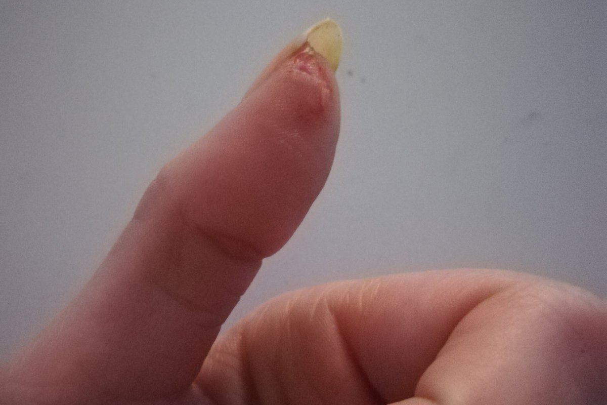 Ich hab gar nichts gemacht! "Mama Finger aua. Mama schneiden in Küche"
🤐😬