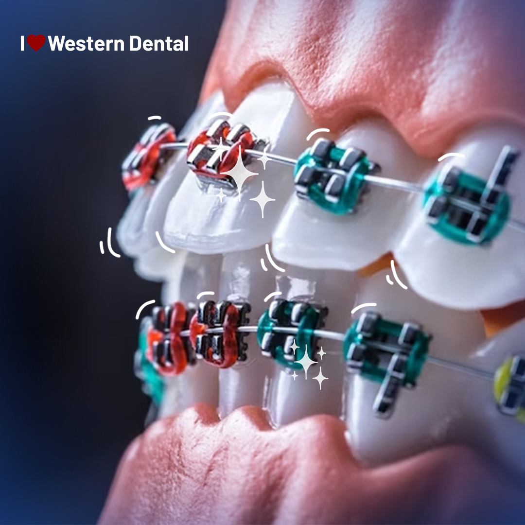 I Love Western Dental tweet media