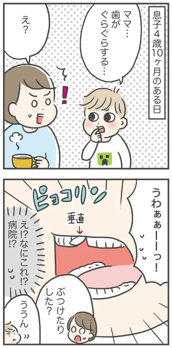 息子4歳11ヶ月、歯が抜ける その1 