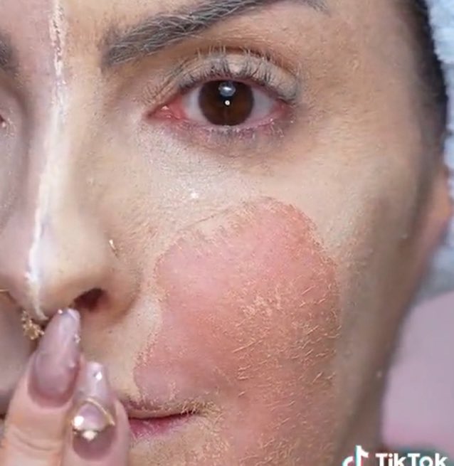 Desde o dia fatídico que a karen bachini desmascarou o enorme esquema de promoções e superfaturamento da Virgínia, eu venho dedicando 5 minutos do meu dia para ver os stories da virginia relacionados a wepink, e este foi o resultado. 

SEGUE O FIO 👇