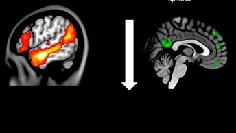 Neuro_Colombia's tweet photo. La conectividad funcional en la resonancia magnética funcional (fMRI) se refiere a una correlación estadística. 

Es la correlación temporal entre regiones cerebrales espacialmente distantes, que puede reflejar el grado en que estas regiones están conectadas funcionalmente. https://t.co/KQbse4WXes