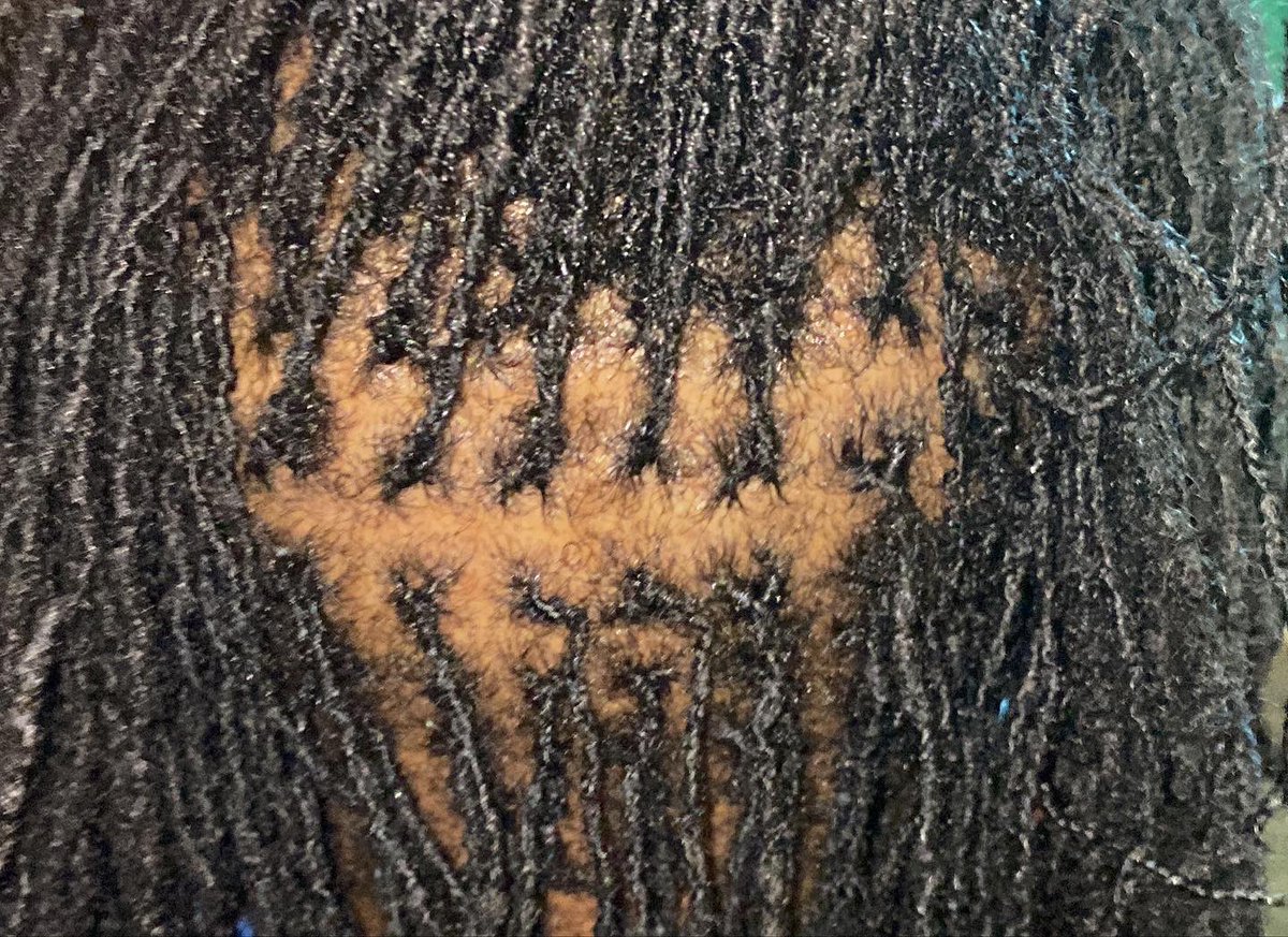 AnelaNewTella's tweet image. #retie #sisterlocks #microlocs #retightening #blackownedbusiness ⭐️⭐️⭐️⭐️⭐️