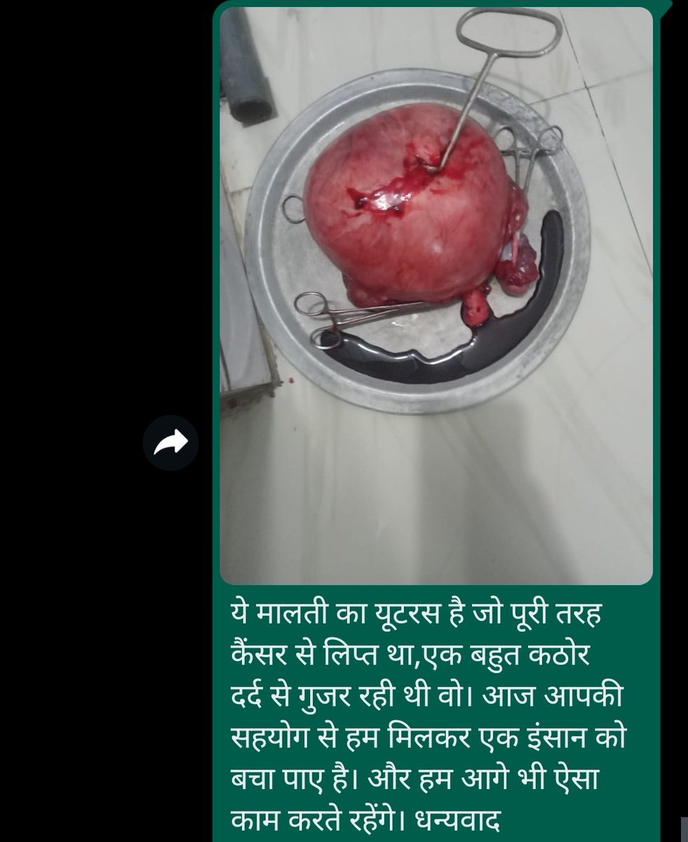 agrimasrivast03's tweet image. आप सभी के सहयोग से हम @MalatiReddy1 का इलाज कराने में सफल हुए है वो महिला जो करीबन 2 साल से यूटरस कैंसर की बीमारी से पीड़ित थी। आप सभी का बहुत बहुत आभार ऐसे ही आगे मदद करते रहे।
#Unityforchange.
@versha5555 @Megha_singh_03 @AMITABHTHAKUR21 @avi_tiwari_SNEH @sonalgoelias