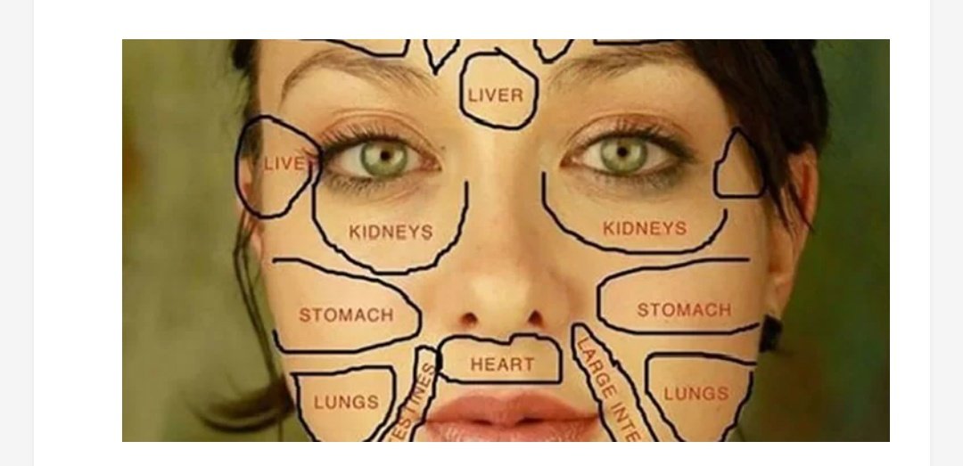 Signs of Fatty Liver on Women’s Face and Skin
shesightmag.com/signs-of-fatty…
Click to read:shesightmag.com/shesight-march…
 #fattyliver #liverhealth #hepatology #liverdisease #liverfailure #liverdamage #livercirrhosis #fattyliversymptoms #fattyliverdisease #liverdetox #healthyliver #SheSight