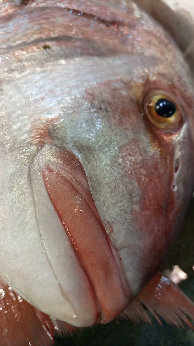 MuradovjMT's tweet image. Aynen canım hiç belli olmuyor dudakların 😁😁 #botox #dudak #trança