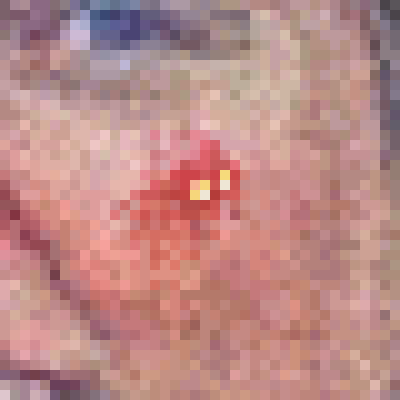 crypto_pimples's tweet photo. This is Crypto Pimple 11670, you may find it at https://t.co/88jGUiBkyG #cryptoPimples https://t.co/wuDYkgzMQ4