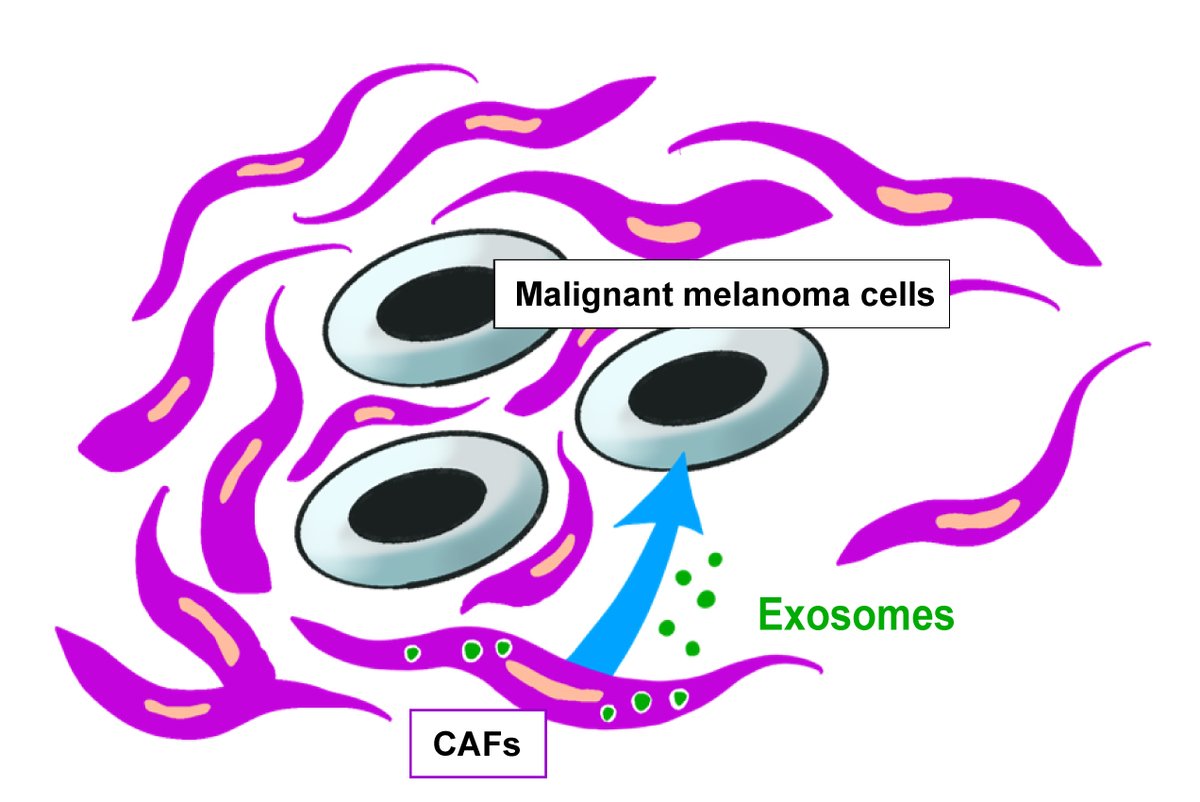 OsakaMetUniv_en's tweet photo. OMU researchers have possibly found a new prognostic indicator for malignant melanoma. They found that cancer-associated fibroblasts produce CD9-positive exosomes in the presence of melanoma cells which also inhibit their growth.
#OMUScience
https://t.co/RCKbrue0rK https://t.co/hSUJ02YFQN