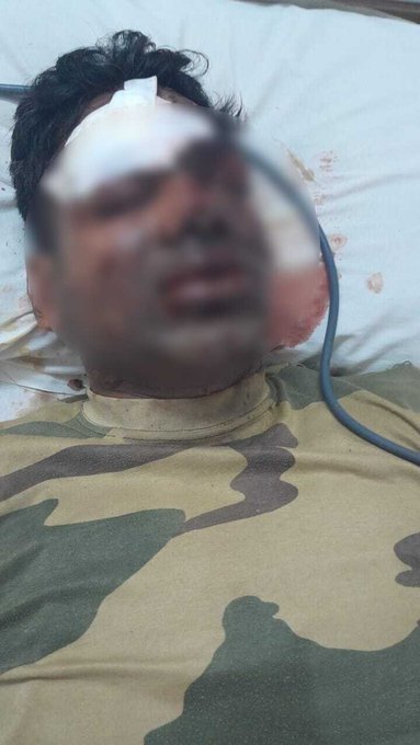 NehaLove28's tweet photo. #BREAKING 
A major accident took place in Kanker district of Chhattisgarh.
Naxalites did IED blast, 2 BSF jawans seriously injured in #Chhattisgarh.  Salute and Respect for our #Bravehearts. #JaiHind 🙏🇮🇳
#NaxalFreeIndia  @ANI @ndtv 
#MaoistAgainstDevelopment 
#TejRan  #AtiqAhmed https://t.co/BcNqoGtBDt