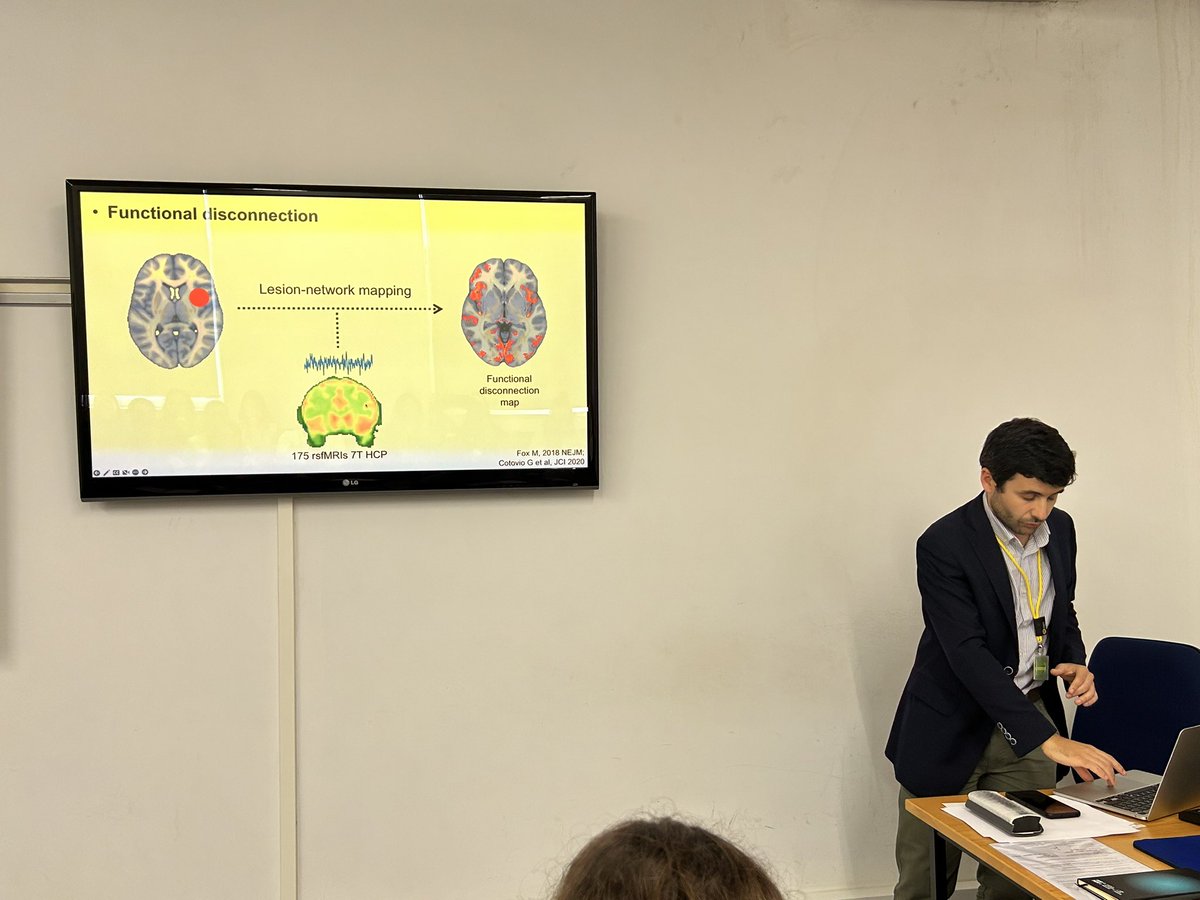luisavlopes's tweet photo. Mais uma excelente sessão #Neuroses @IMMolecular com o fantástico trabalho do Pedro Alves, neurologista e investigador clínico @medicina_lisboa #caml #chln que estuda os mecanismos dos delírios de espaço na sequência de AVC. Apoio @Roche https://t.co/F0QAmeBqUg
