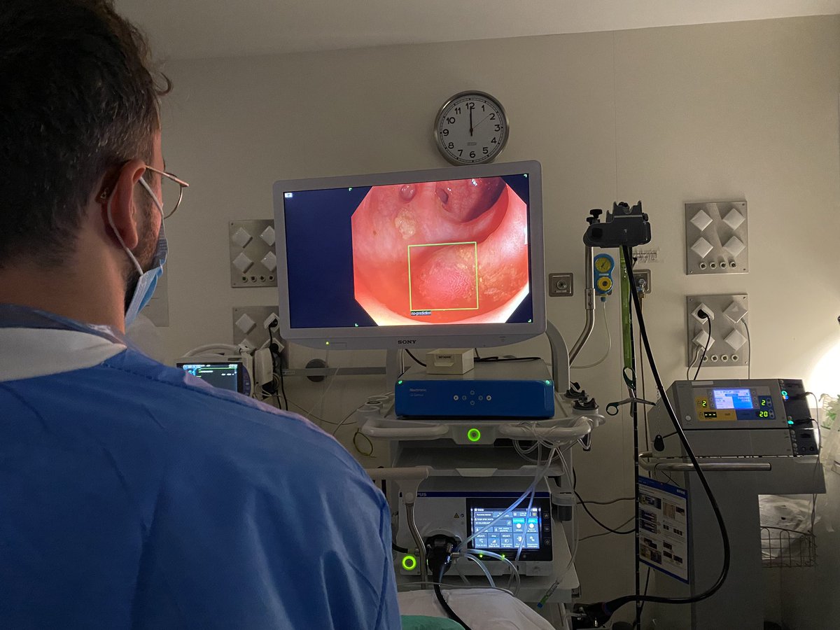 DigestiuHV's tweet photo. Ya tenemos la nueva actualización del GI-Genius instalada en la Unidad de Endoscopias de @DigestiuHV, que permite realizar detección y clasificación histológica de lesiones colorrectales en tiempo real #AI #CADe #CADx #realtime @MedtronicES @alfonstapias https://t.co/CVLtsHjktV