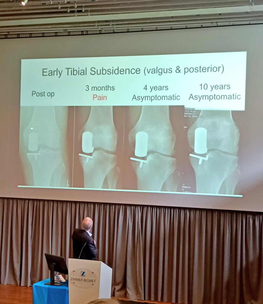 AlazzaniWaheeb's tweet photo. Great day @KebleOxford for the Oxford partial knee replacement by great faculty from @oxfordkneegroup  #Oxford @zimmerbiomet @UniofOxford @KebleConference #knee #Orthopedics #orth https://t.co/d4x8q0tW6L