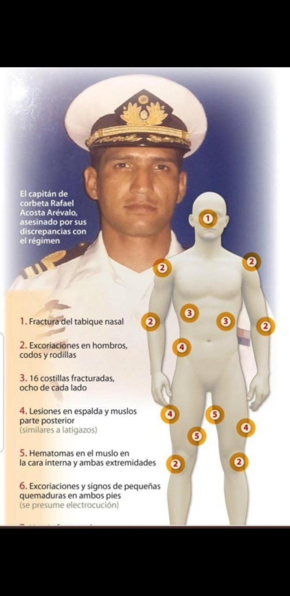 waleswka77's tweet photo. Hoy se cumple 44 meses del asesinato por tortura Rafael Acosta Arévalo, aún falta por investigar y determinar las responsabilidades penales de la Cadena de mando,"Detención arbitraria, desaparición forzada, tortura, muerte" hasta la fecha no se puede hablar de justicia en su caso https://t.co/2aI4tgp5QP