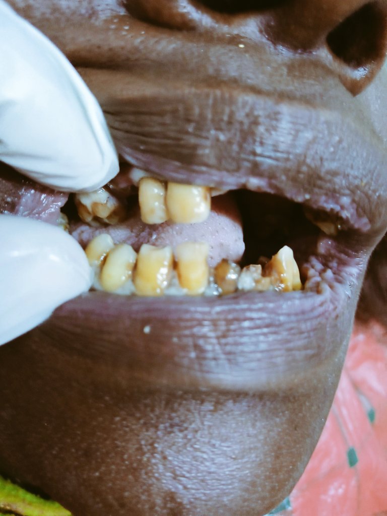 TeethJoel's tweet photo. https://t.co/MLW9burj21