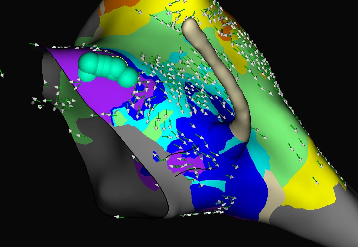 Francesco Peruzza tweet media