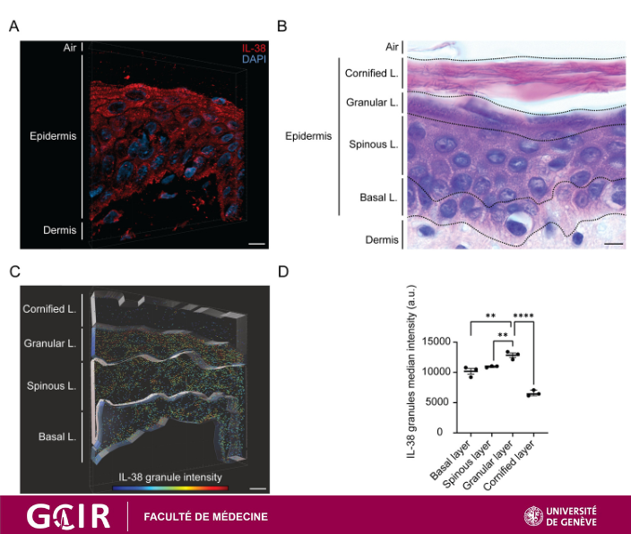 GCIR_Unige's tweet photo. IL-1 family #cytokines are fascinating! @GCIR_Unige Pr Gaby Palmer and her team suggest in this new preprint that the formation of IL 38 condensates may be involved in #epidermal differentiation & #skin homeostasis. Read it here! https://t.co/rMGSj53bm6
@unige_en @Hopitaux_unige https://t.co/zrwlhmHPiZ