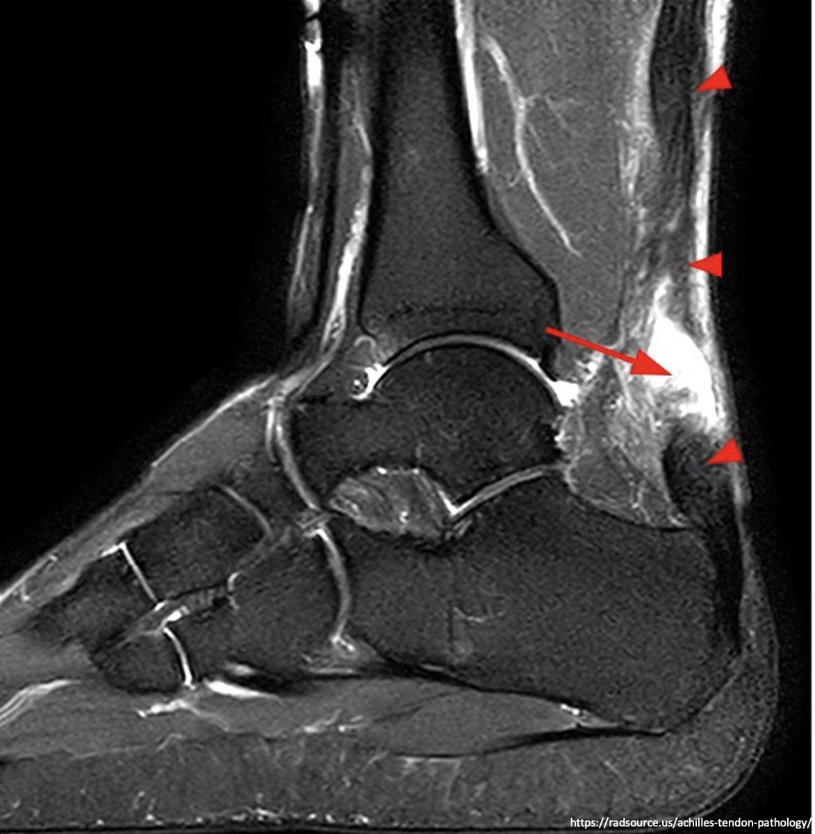 Journal of Brown Hospital Medicine tweet media