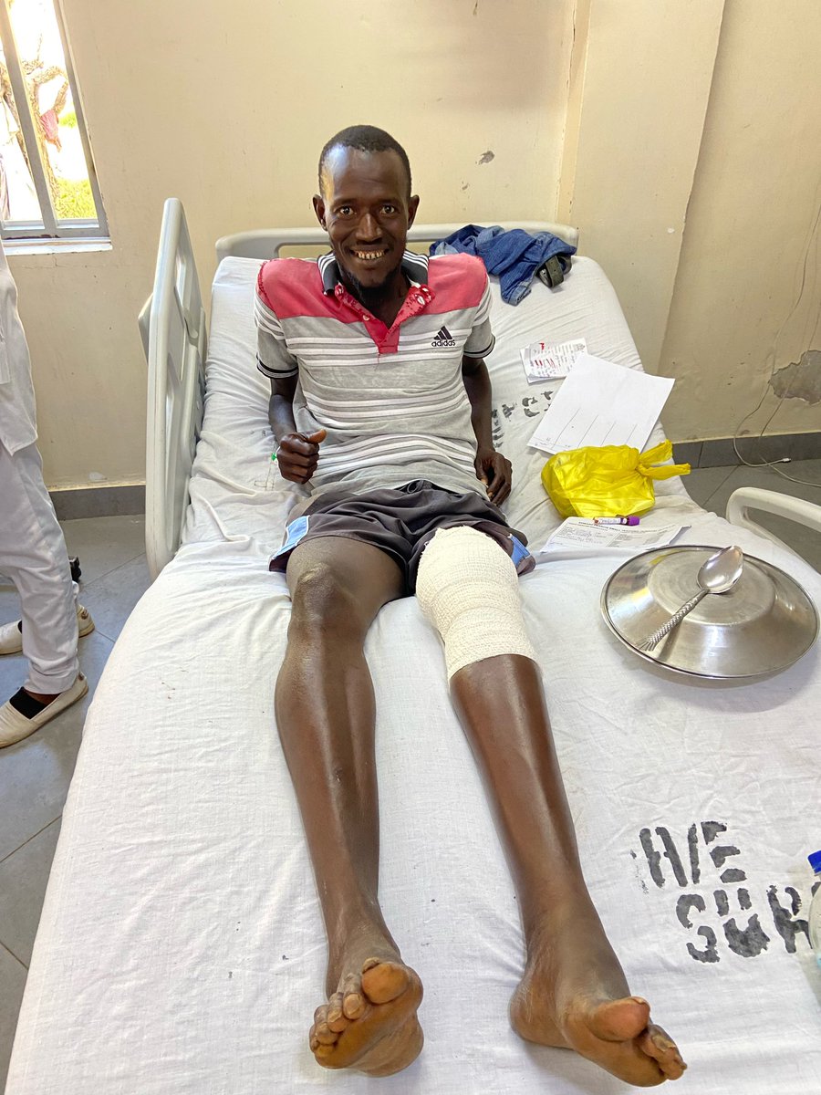 On our recent trip to the Gambia, the team operated on this man who’d had a previous football injury as a teenager which had resulted in a knee deformity. 

The surgeons operated to straighten out his leg and correct the deformity. 

Pre and post op gait videos coming soon…