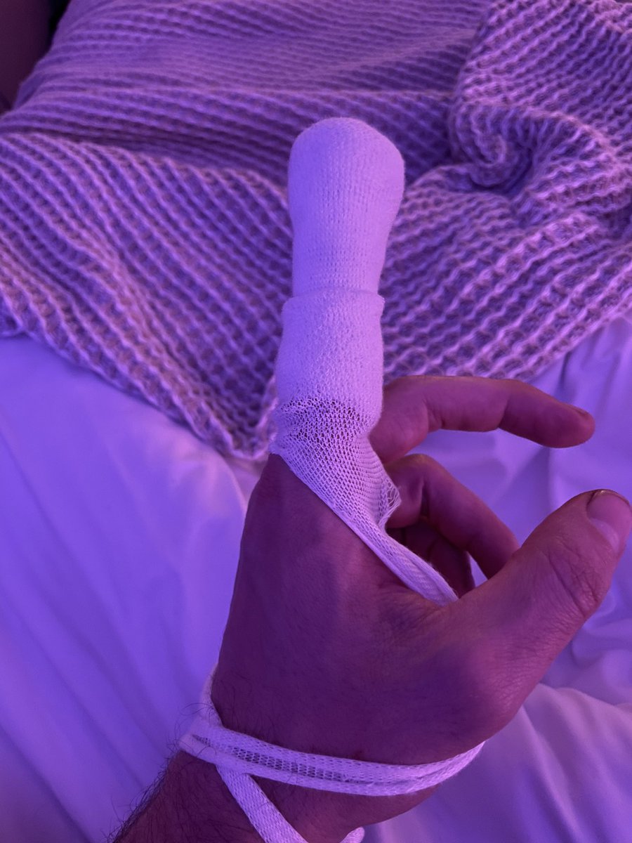 Don’t try to win a fight with a table saw, you will lose…