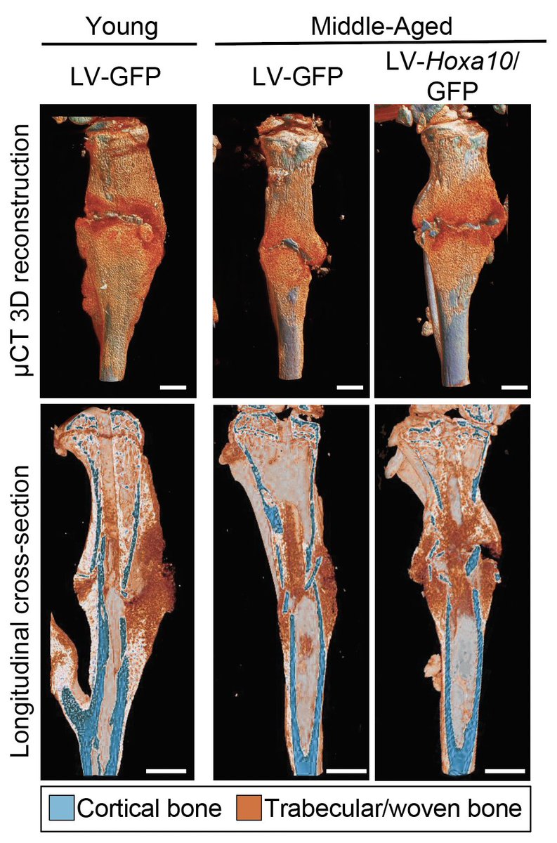 Excited to share my work in <a href="/Dev_journal/">Development</a> on the role of Hox genes in adult skeletal stem cells &amp; bone regeneration 🦴🍗 #leuchtlab #boneregeneration #stemcells #devbio <a href="/nyulangone/">NYU Langone Health</a> <a href="/NYULH_postdocs/">NYU Langone Postdoctoral Affairs</a>
 <a href="/PhilippLeuchtMD/">Philipp Leucht, MD</a> <a href="/Morgani_S/">Dr. Sophie Morgani</a> journals.biologists.com/dev/article/15…