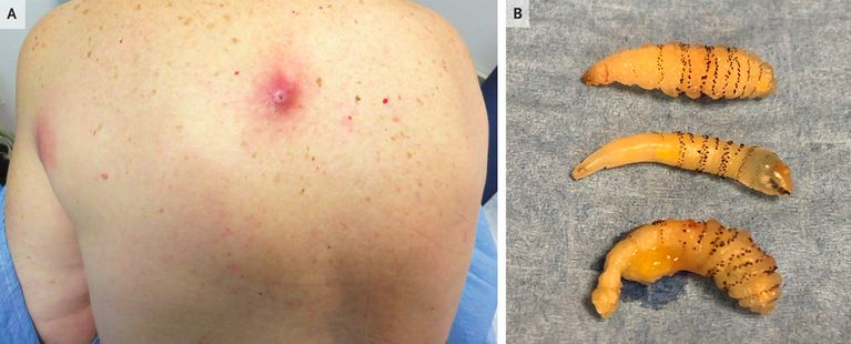 Marc Gozlan tweet media