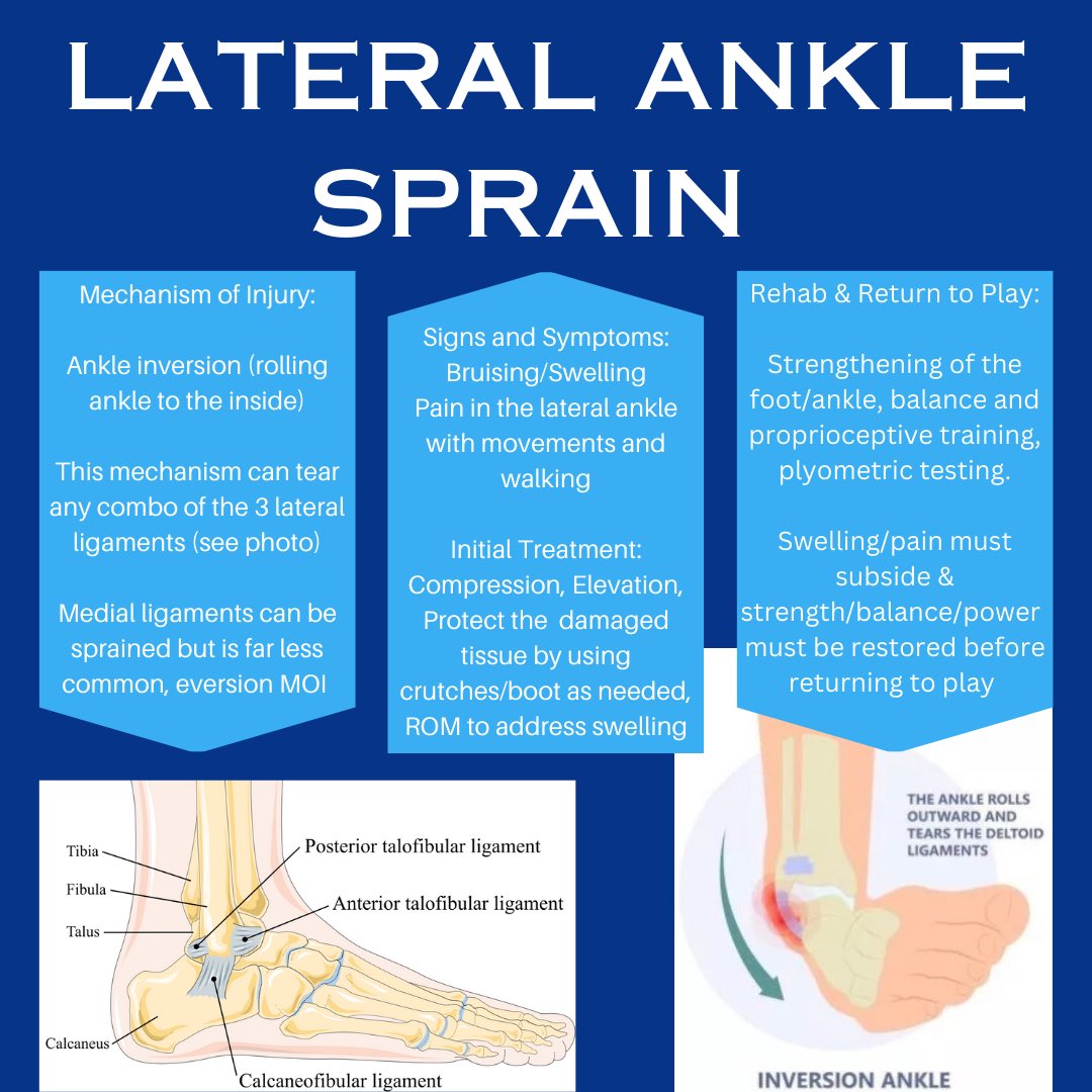 SportsMedCN's tweet photo. A look into common ankle injuries in athletics: #athletictraining #NATM2023 #TheresAnATForThat #TNATA #WeAreD9 #IAmD9 https://t.co/fF7INz3tlQ